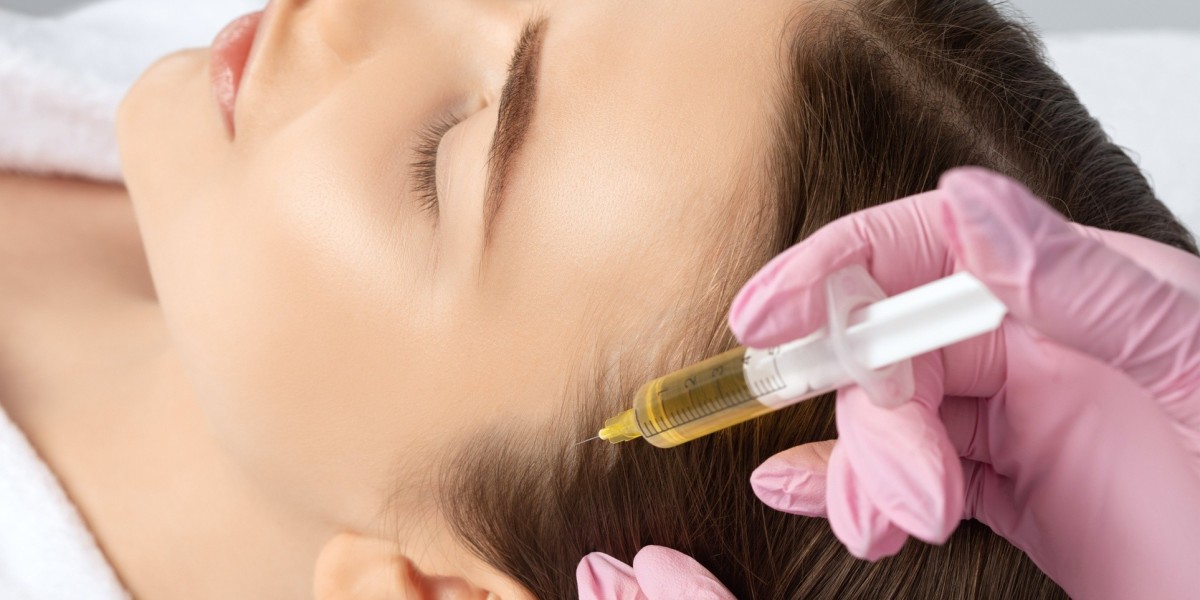 How PRP Therapy Improves Scalp Health and Hair Texture