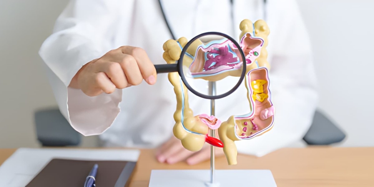 Evolving Outlook on Crohn’s Disease: Causes, Symptoms, and Future Directions