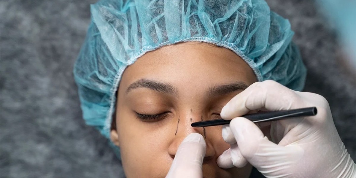 Rhinoplasty methods in Dubai designed for refined nasal artistry