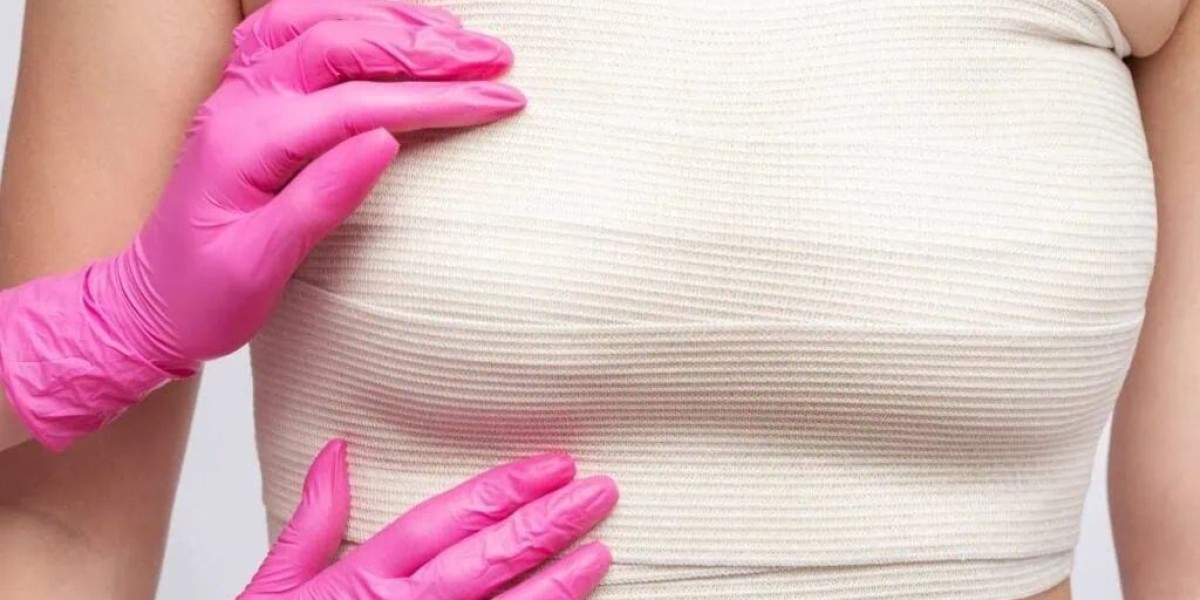 What Is the Ideal Recovery Timeline After Breast Augmentation?