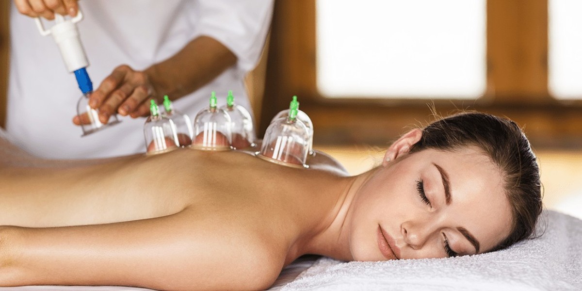 Experience Deep Healing And Detox With Hijama Cupping Therapy