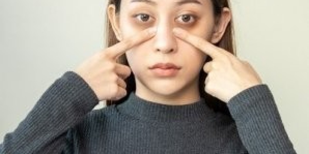 What Is the Best Clinic Treatment for Dark Circles?