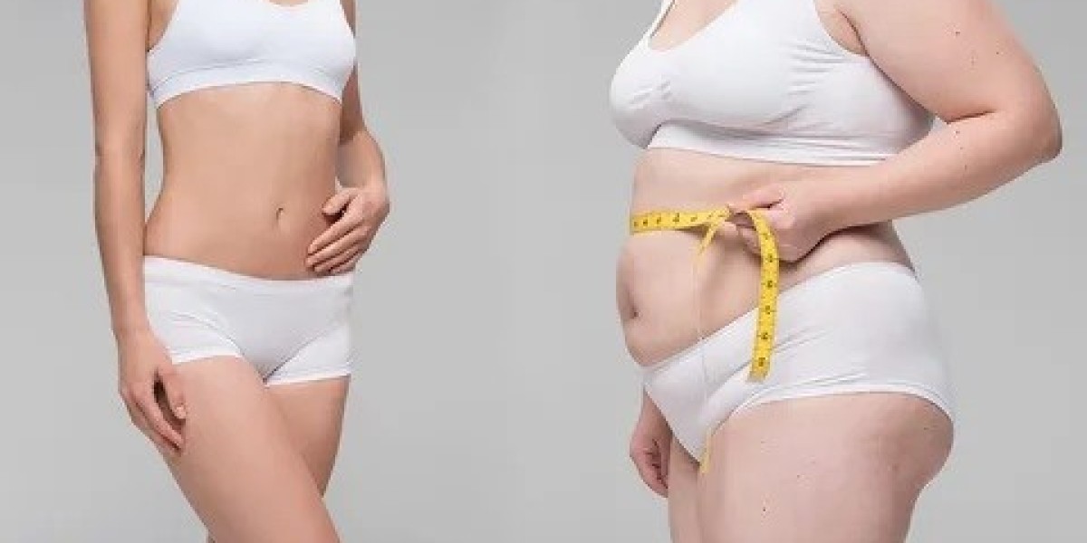 How Effective Is Non-Surgical Weight Loss Treatment in Islamabad?