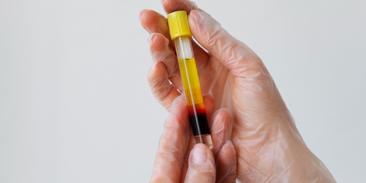 What is an ESR Test? Purpose, Procedure & Meaning