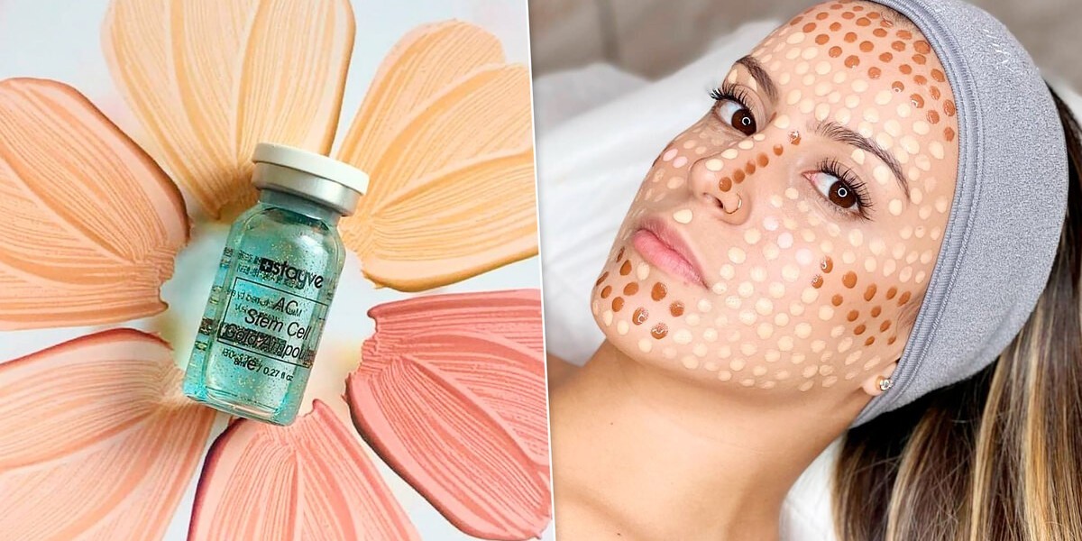 How Long Does Radiant Skin Really Last? A Realistic Look at Results and Upkeep