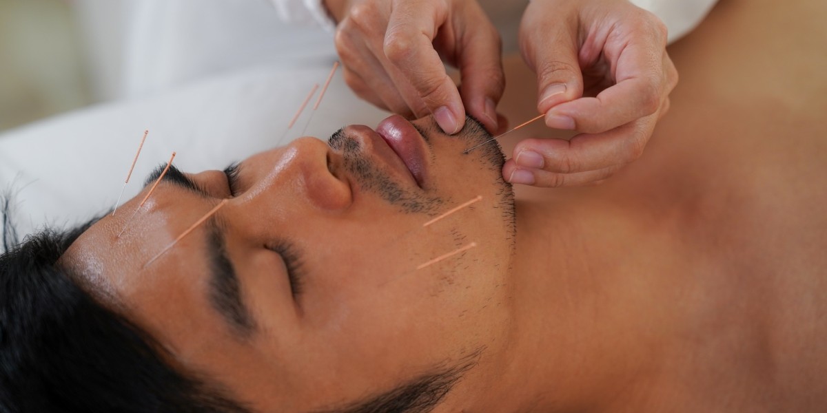 Affordable Holistic Facial Acupuncture in Philadelphia