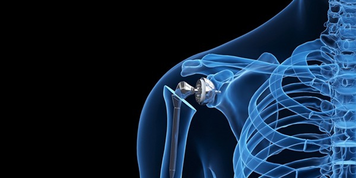 What is reverse shoulder replacement?