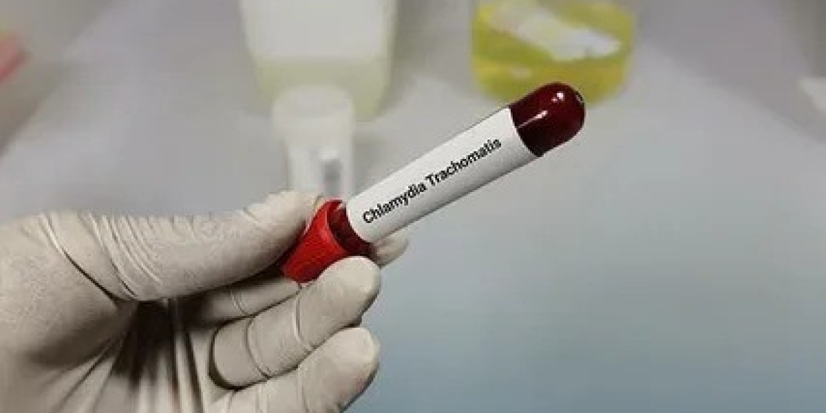 Chlamydia Test in Dubai: Understanding the Testing Process